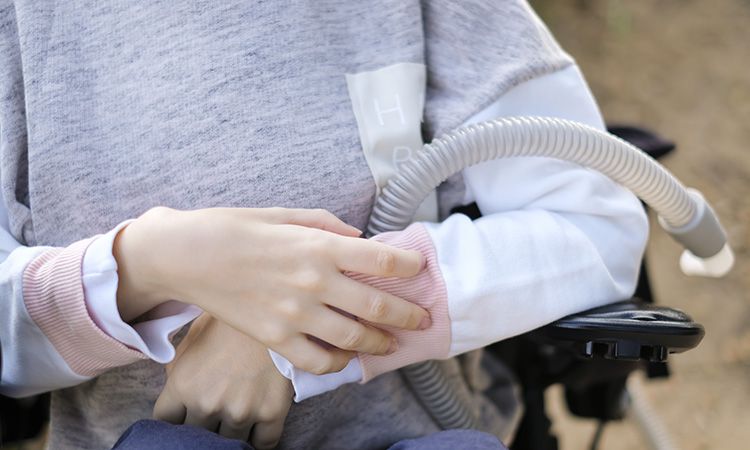 Rdzeniowy zanik mięśni (SMA) - objawy, diagnostyka, leczenie