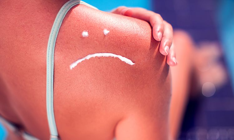Uczulenie na słońce i fotodermatozy - przyczyny, objawy, zapobieganie