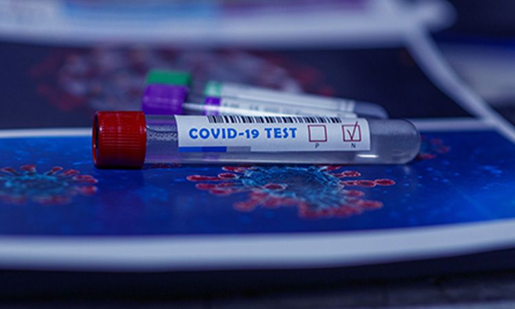 Rodzaje testów na obecność koronawirusa. Jak działają i ile kosztują?