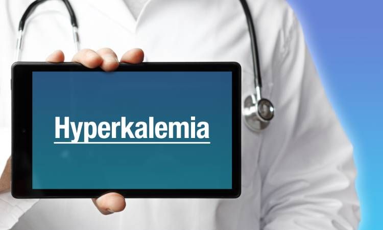 Hiperkaliemia – nadmiar potasu w organizmie: objawy i leczenie