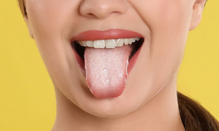 Pleśniawki w jamie ustnej - przyczyny i sposoby leczenia